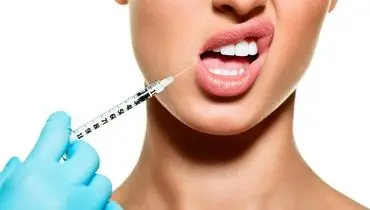 علت ایجاد تبخال بعد از تزریق ژل لب