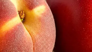آیا اصلاح موهای ناحیه تناسلی ضروری است؟ بررسی دیدگاه‌های مختلف